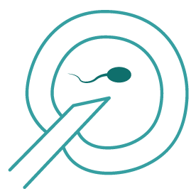 IVF และ ICSI คืออะไร